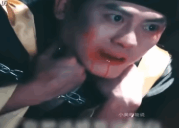 H0411003 Ipinanganak ang tatlong buwang gulang na sanggol na nakasuot ng part2