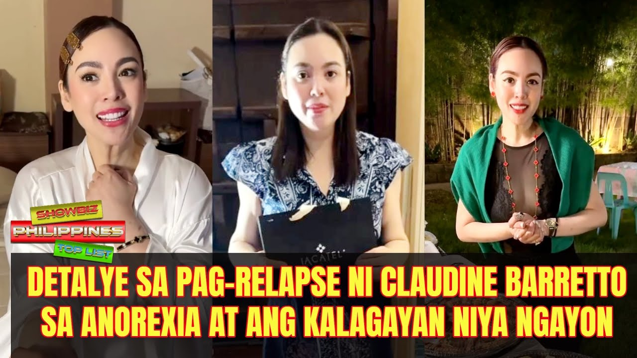 Claudine Barretto at ang Pag‑Relapse sa Anorexia: Ang Laban sa Mental Health at Pressures ng Showbiz.