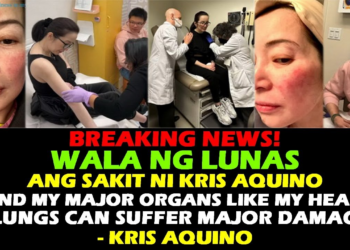 Kris Aquino, Inamin ang Masakit na Katotohanan: ‘Wala nang Lunas ang Aking Sakit’