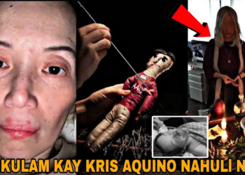 Misteryo sa Likod ng Sakit ni Kris Aquino: Teorya ng Kulam at Babala ng mga Visionary, Nagbigay-Gimbal sa Publiko!
