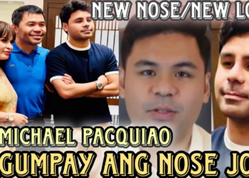 MICHAEL PACQUIAO’S NEW NOSE AFTER A SUCCESSFUL NOSE JOB — MOMMY JINKEE AND DAD MANNY PROUD AND HAPPY  (NH)